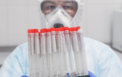 Rusija razvija 17 potencialnih cepiv proti covidu-19